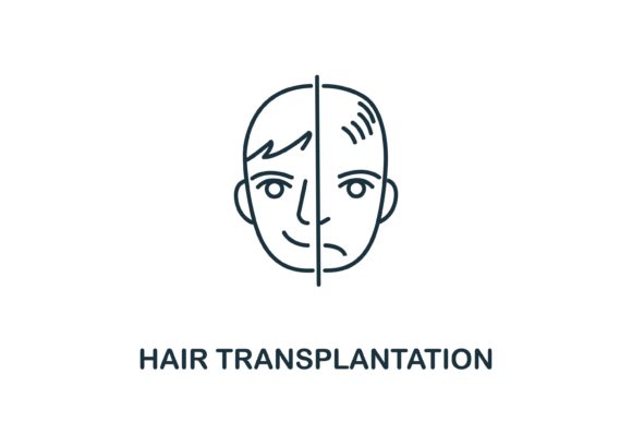 Hair Transplantation: A Process-Oriented Approach to Integration and Implementation